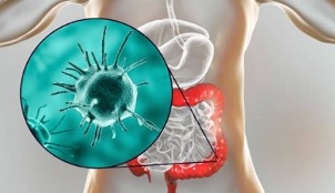 which tests to take for parasites