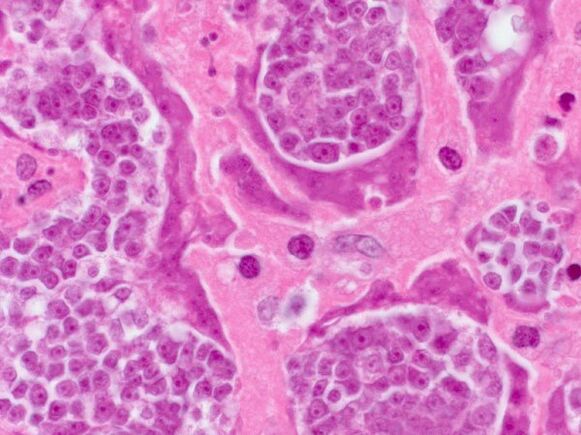 Parasite survey in a person