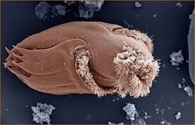 Pathogenic microorganisms in humans