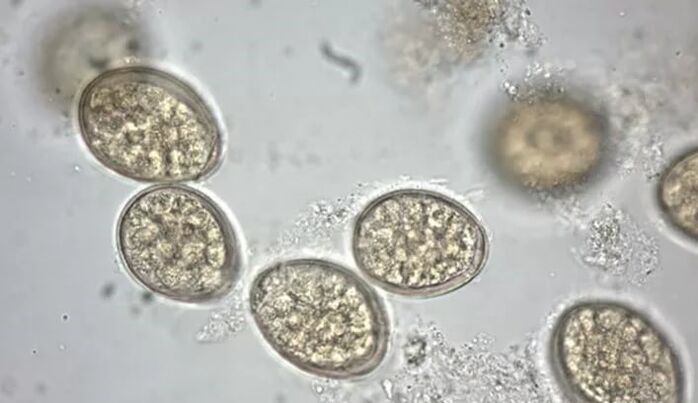 parasites under the microscope