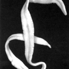 Tape with ribbons in the human body