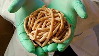 Methods of removing parasites from the body